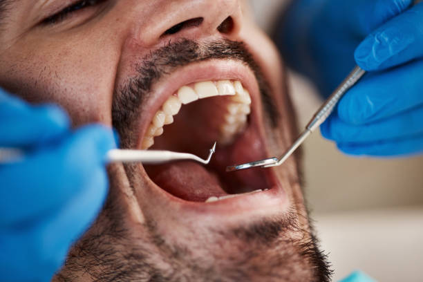 Emergency Dental Services in Folsom, NJ